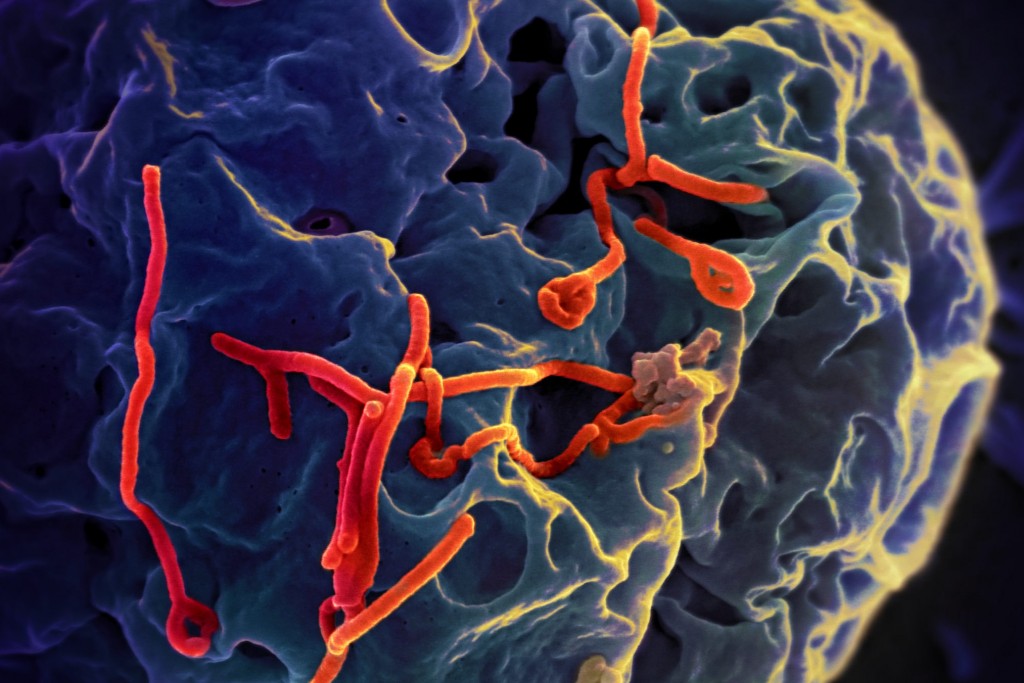 NAID ebola image
