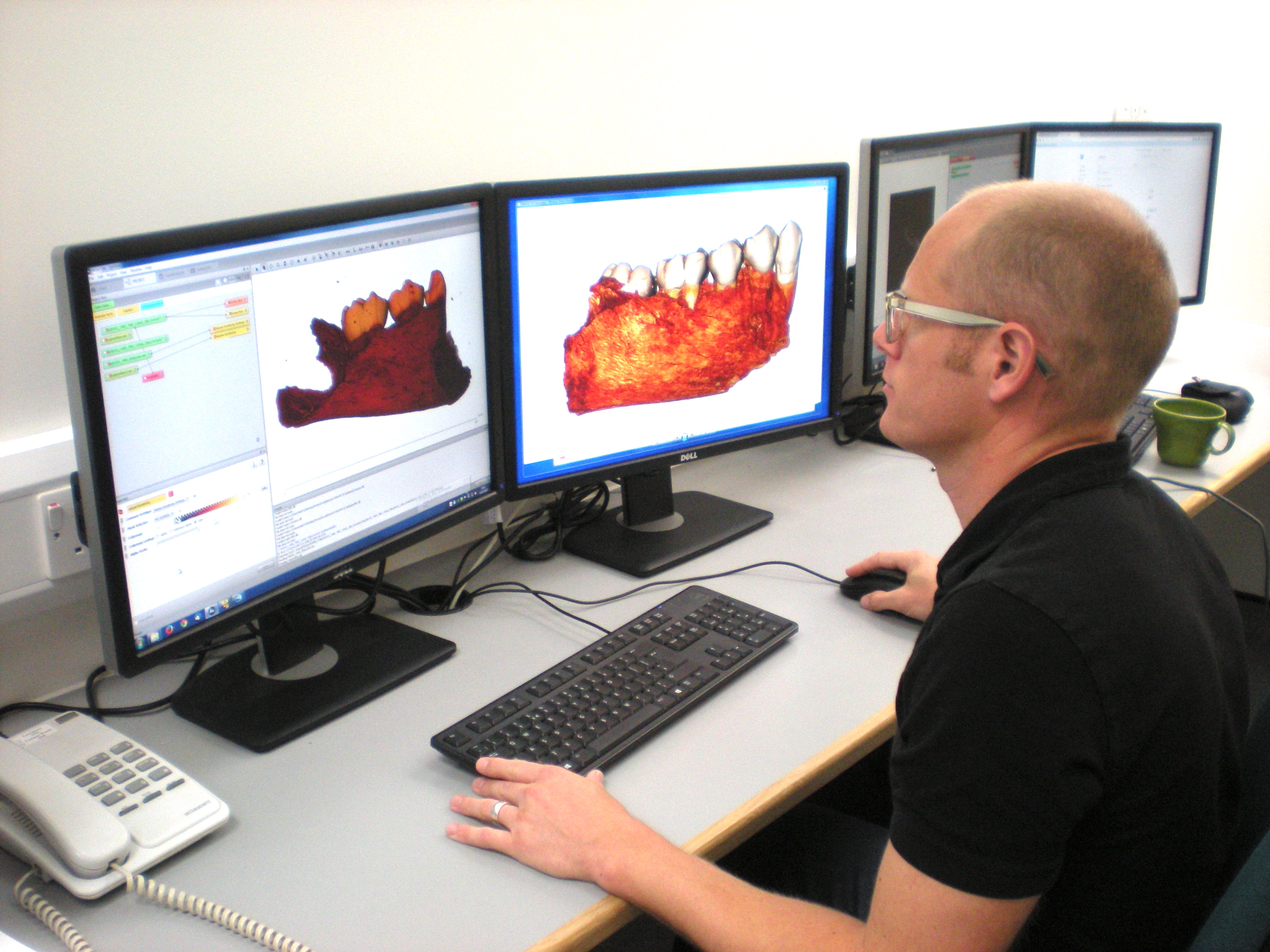 Matthew Skinner working with the scans that the Diondo D will generate.