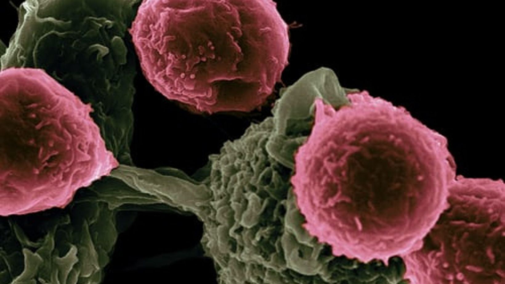 macroscopic view of cancer cells