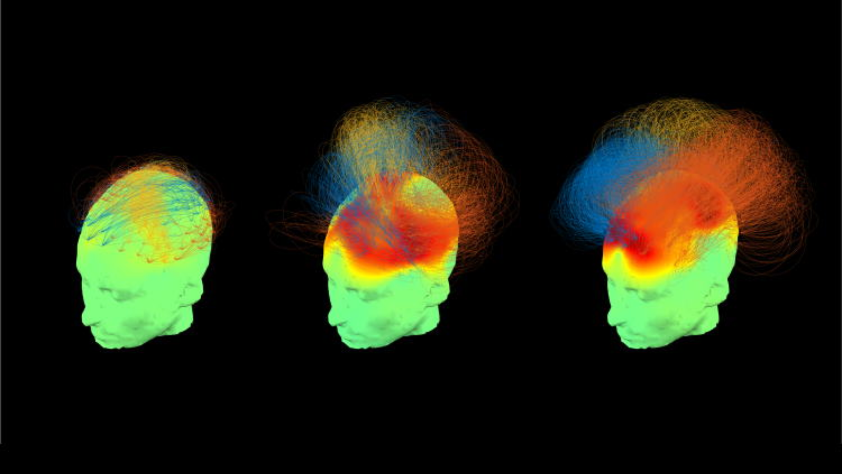 Scientific images of heads with lines coming out of them representing cognitive patterns