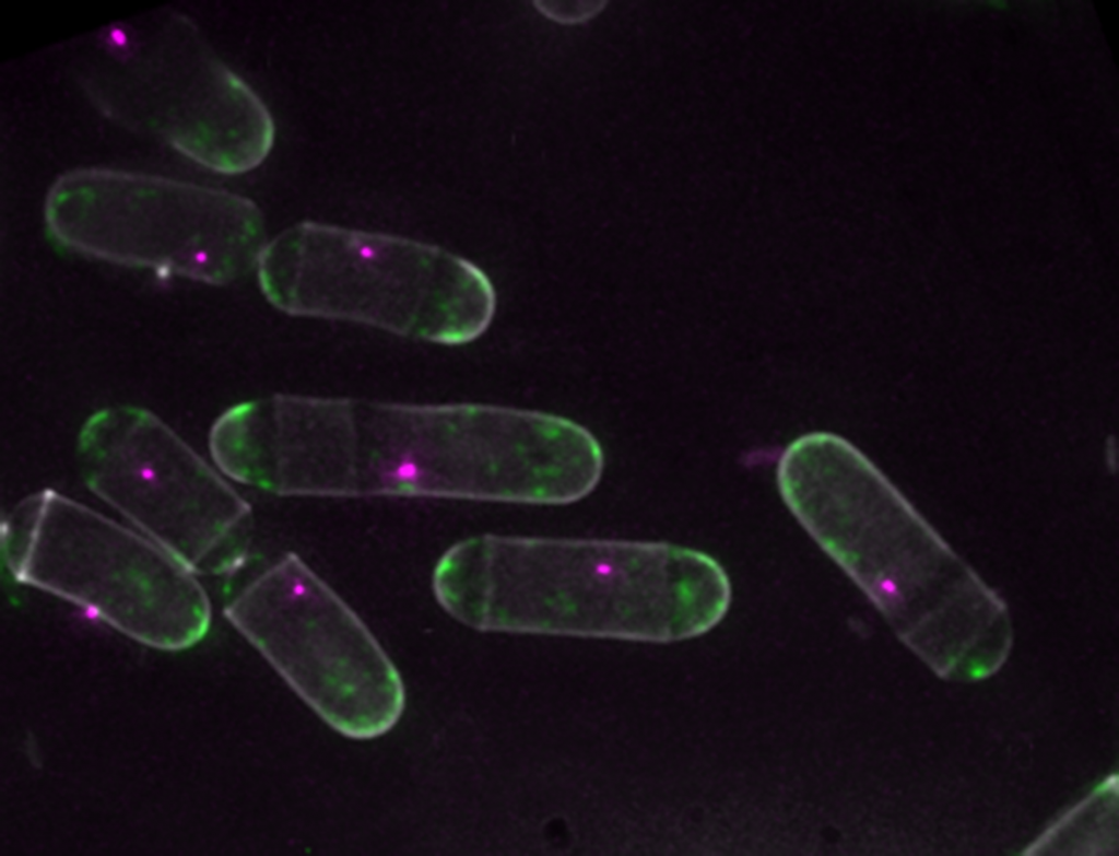 image shows living yeast cells, which have been modified to allow us to fluorescently label specific motor proteins (green) and regulatory structures (magenta)