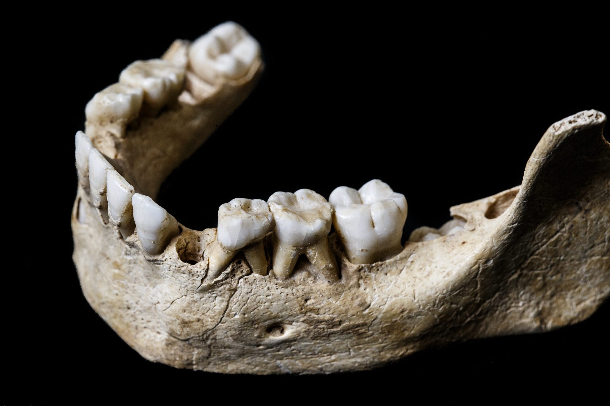 Image of mandible and teeth