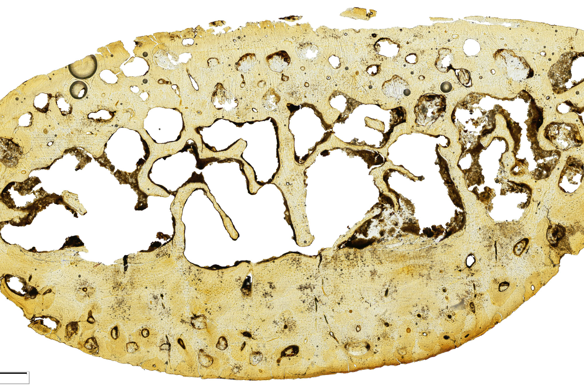 A cross-section of the rib (100x magnification) of an eight year-old child from medieval Canterbury.