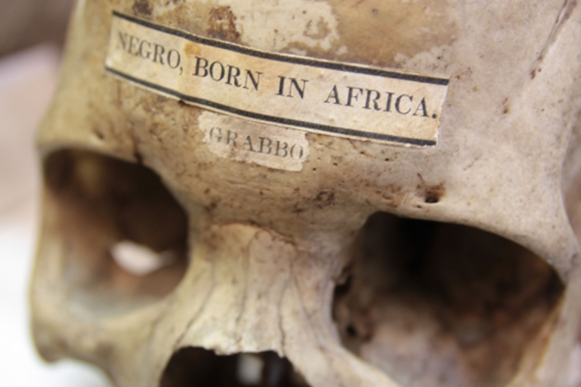 Skull with label across its forehead reading 'Negro - Born in Africa'