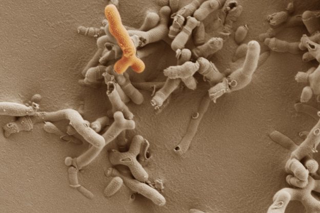 The dominant infant microbiota member Bifidobacterium